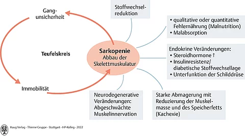 Schaubild mit Einflussfaktoren für eine Sarkopenie (Abbau der Skelettmuskulatur).
