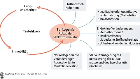 Schaubild mit Einflussfaktoren für eine Sarkopenie (Abbau der Skelettmuskulatur).