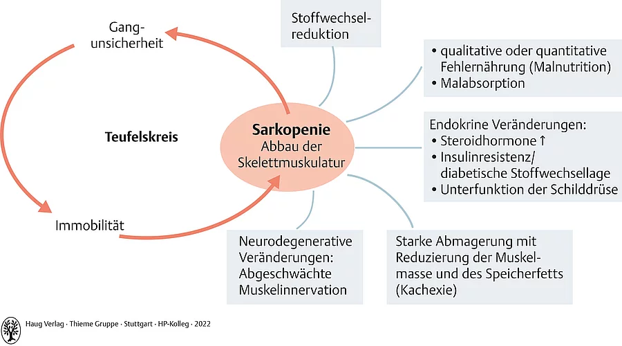 Schaubild mit Einflussfaktoren für eine Sarkopenie (Abbau der Skelettmuskulatur).