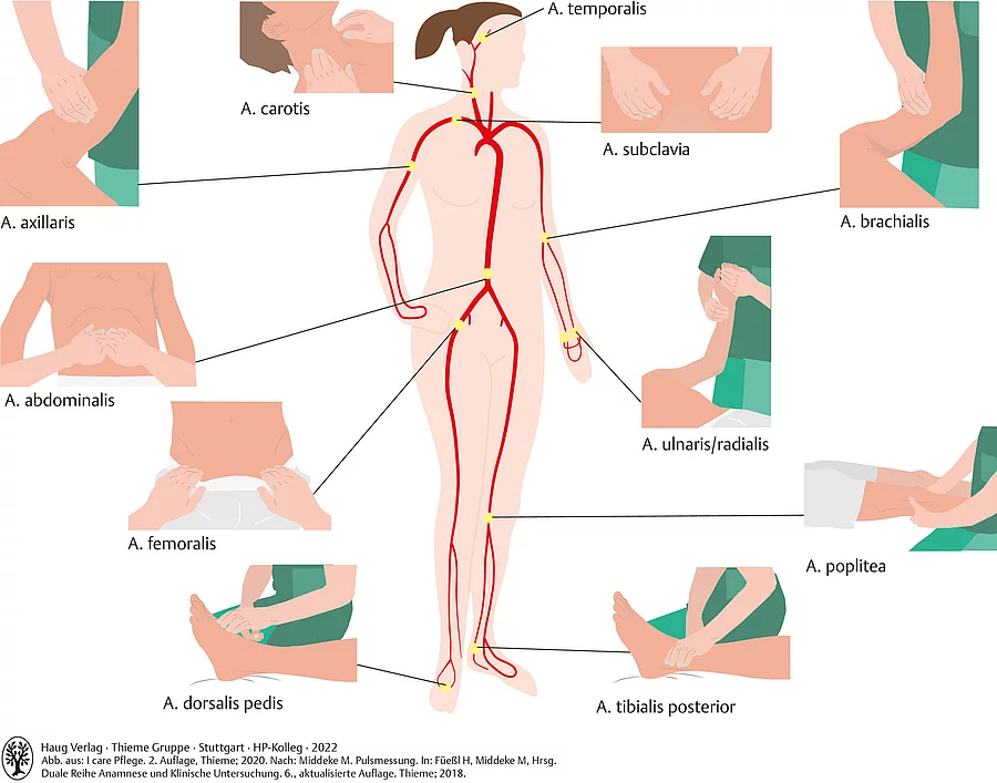 Darstellung eines Menschen und einzelner Körperteile mit Taststellen zur Palpation des Pulses an verschiedenen Arterien.