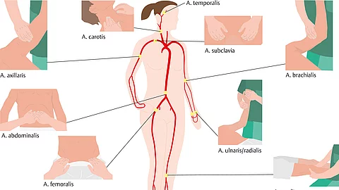 Darstellung eines Menschen und einzelner Körperteile mit Taststellen zur Palpation des Pulses an verschiedenen Arterien.