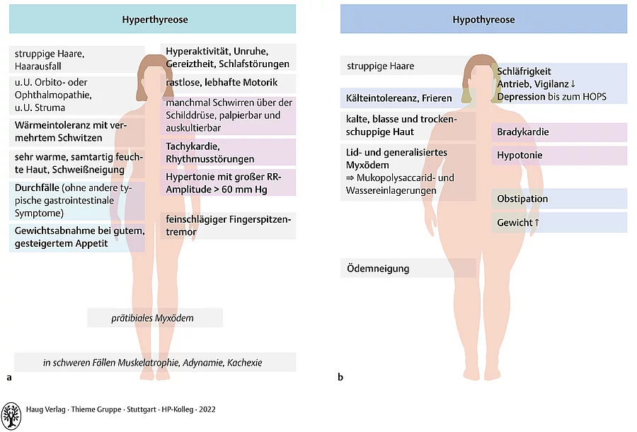 Überblick zu den Symptomen bei Hypothyreose und Hyperthyreose anhand von Zeichnungen zwei menschlicher Körper von vorne.
