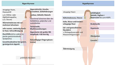 Überblick zu den Symptomen bei Hypothyreose und Hyperthyreose anhand von Zeichnungen zwei menschlicher Körper von vorne.