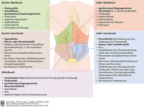 Übersicht Differenzialdiagnosen akutes Abdomen. Einteilung in rechter und linker Oberbauch, rechter und linker Unterbauch und Mittelbauch.