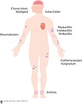 Darstellung eines menschlichen Körpers von vorne mit eingezeichneten Symptomen und Komplikationen bei rheumatischem Fieber.