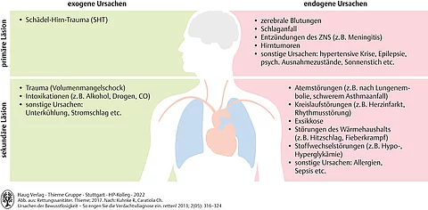 Übersicht zu endogenen und exogenen Ursachen von Bewusstseinsstörungen. Abgebildet ist ein gezeichnet Kopf und Rumpf mit Organen.