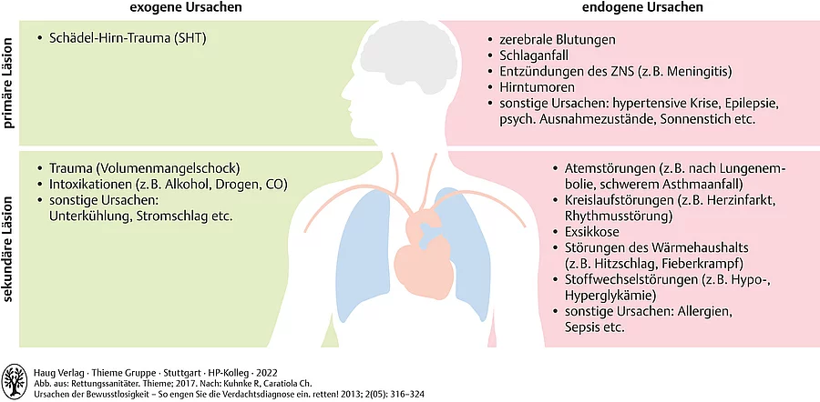 Übersicht zu endogenen und exogenen Ursachen von Bewusstseinsstörungen. Abgebildet ist ein gezeichnet Kopf und Rumpf mit Organen.
