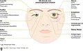 Schematische Zeichnung eines Gesichts mit eingezeichneten Stellen für den Inspektionsbefund am Auge. 