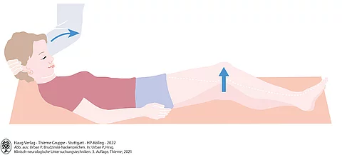 Mensch in Rückenlage mit positivem Brudzinski-Zeichen: Bei Vorbeugen des Kopfes werden reflektorisch die Knie gebeugt.